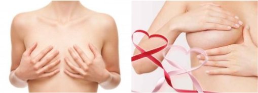 女性の病気,女性の悩み,子宮病